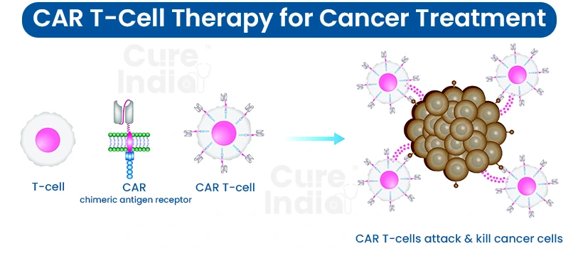 CAR T-Cell Therapy in India